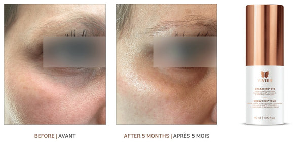 Vivier GrenzCine Eye