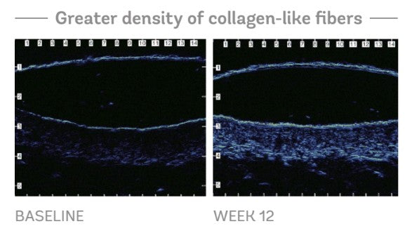 Vivier GrenzCine Serum